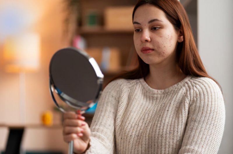 5 signs you should see a dermatologist immediately
