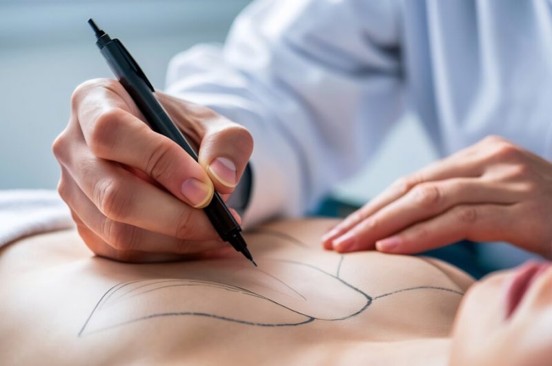 Surgical Oncolog